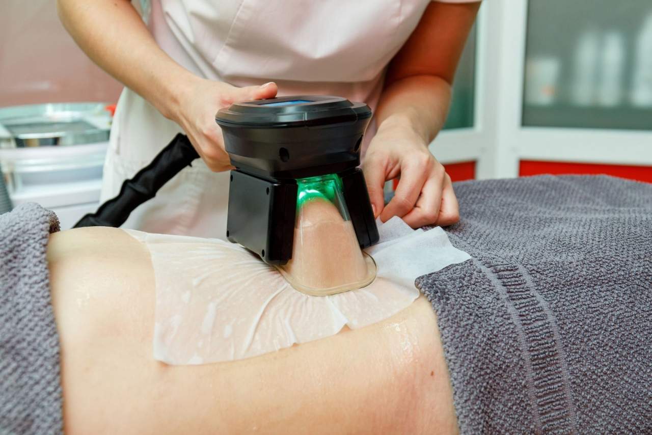 Criolipolisis médica: eliminar grasa localizada en Santiago de Compostela gracias a la Dra. Alfonsina Uriburu
