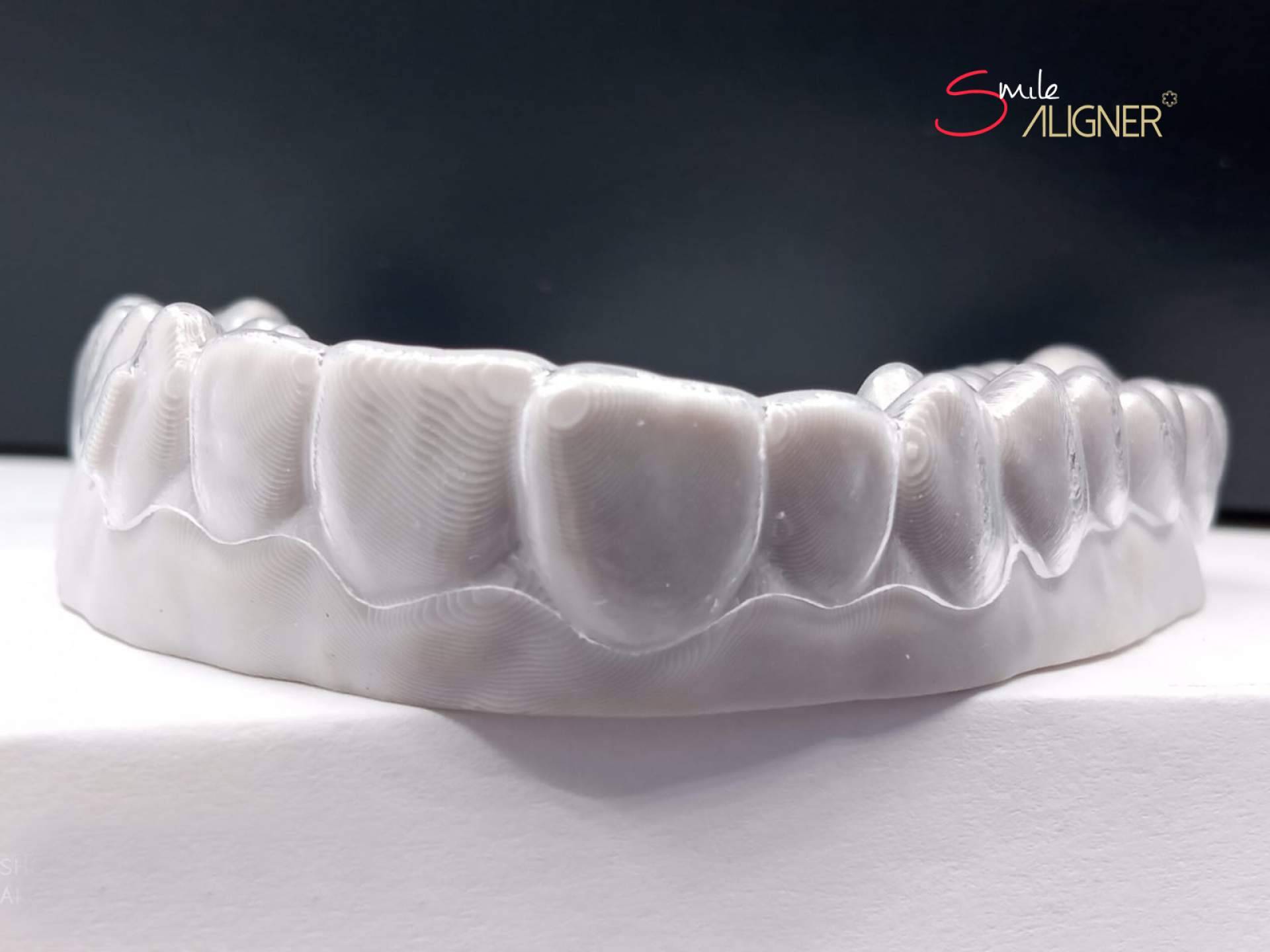 Clínicas Hernadent: Smile Aligner, la novedosa ortodoncia invisible exclusiva del centro