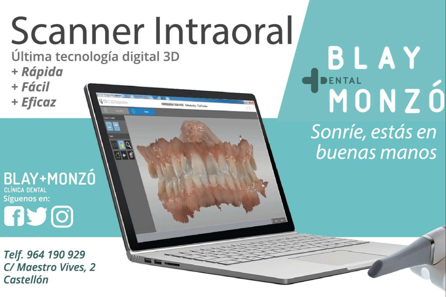 Las técnicas avanzadas en implantología: odontología digital de la mano de Clínica Blay Monzó