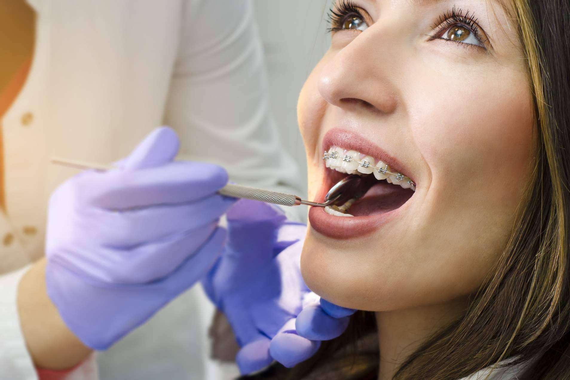 Helident Clínica Dental pone a disposición múltiples opciones de tratamiento de ortodoncia con brackets