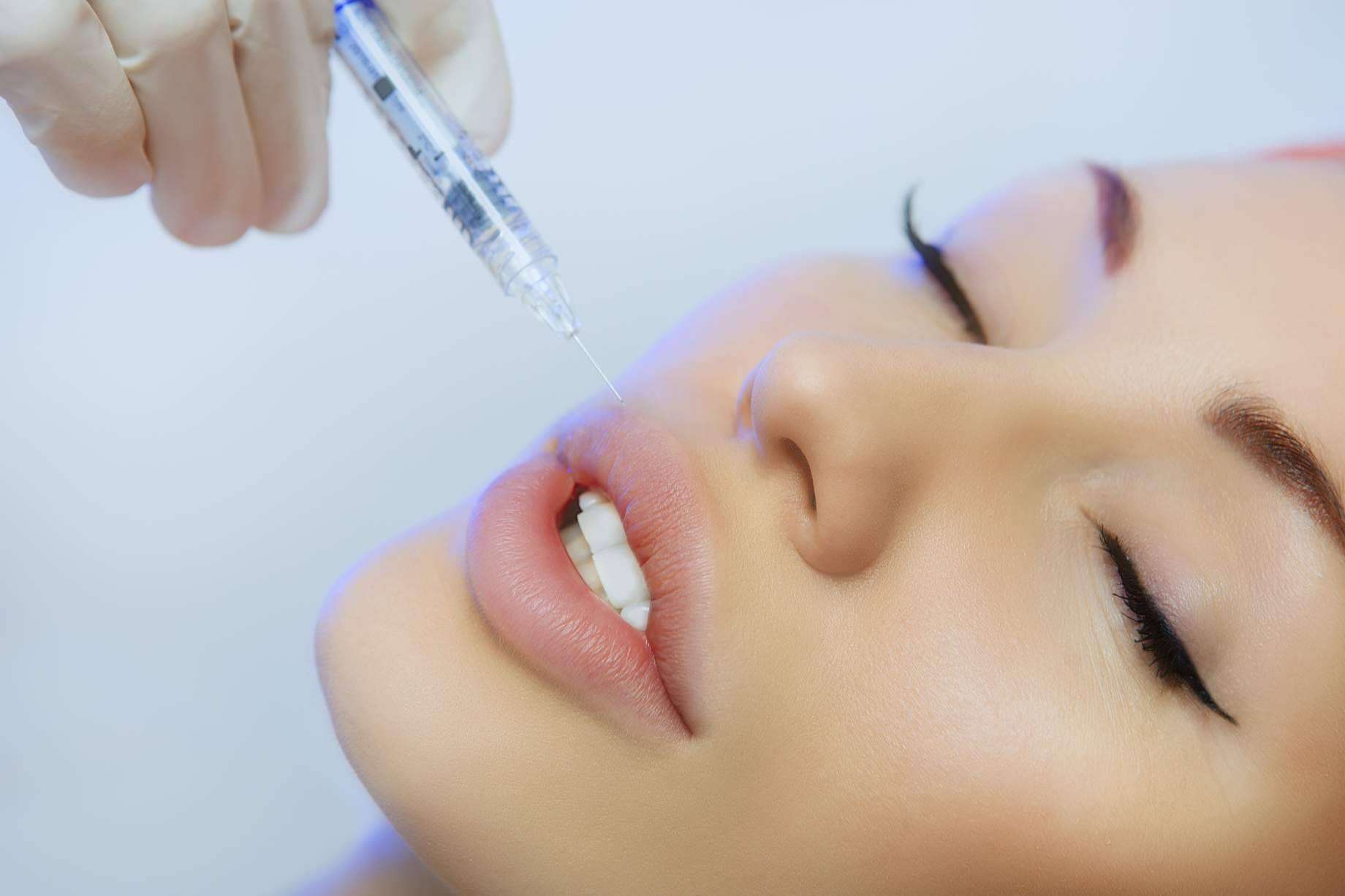 Aumento de labios en Barcelona de la mano del Dr. Carlos Zito