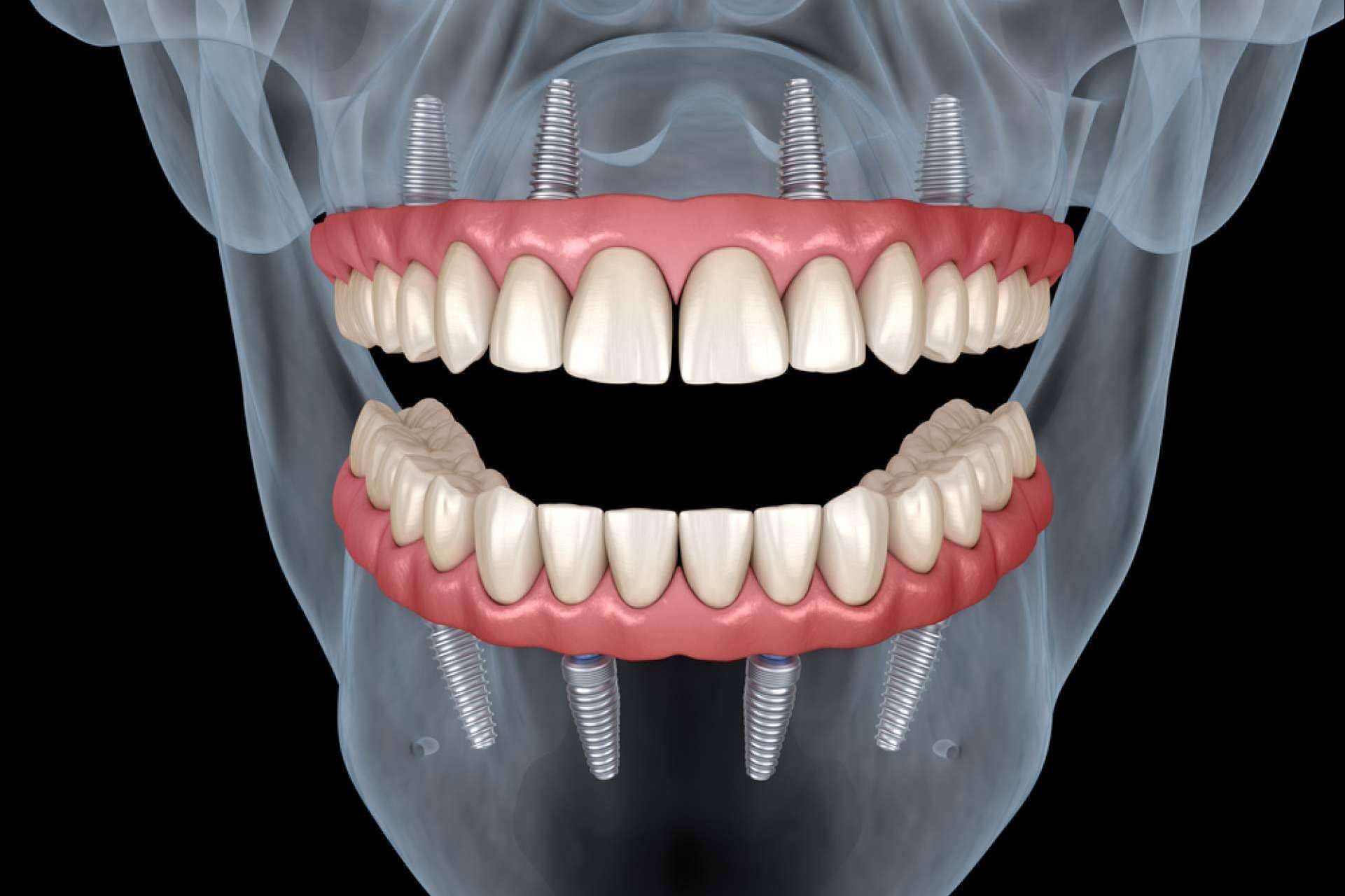 Conseguir una sonrisa perfecta con DeltaDent, la clínica dental de Chamartín