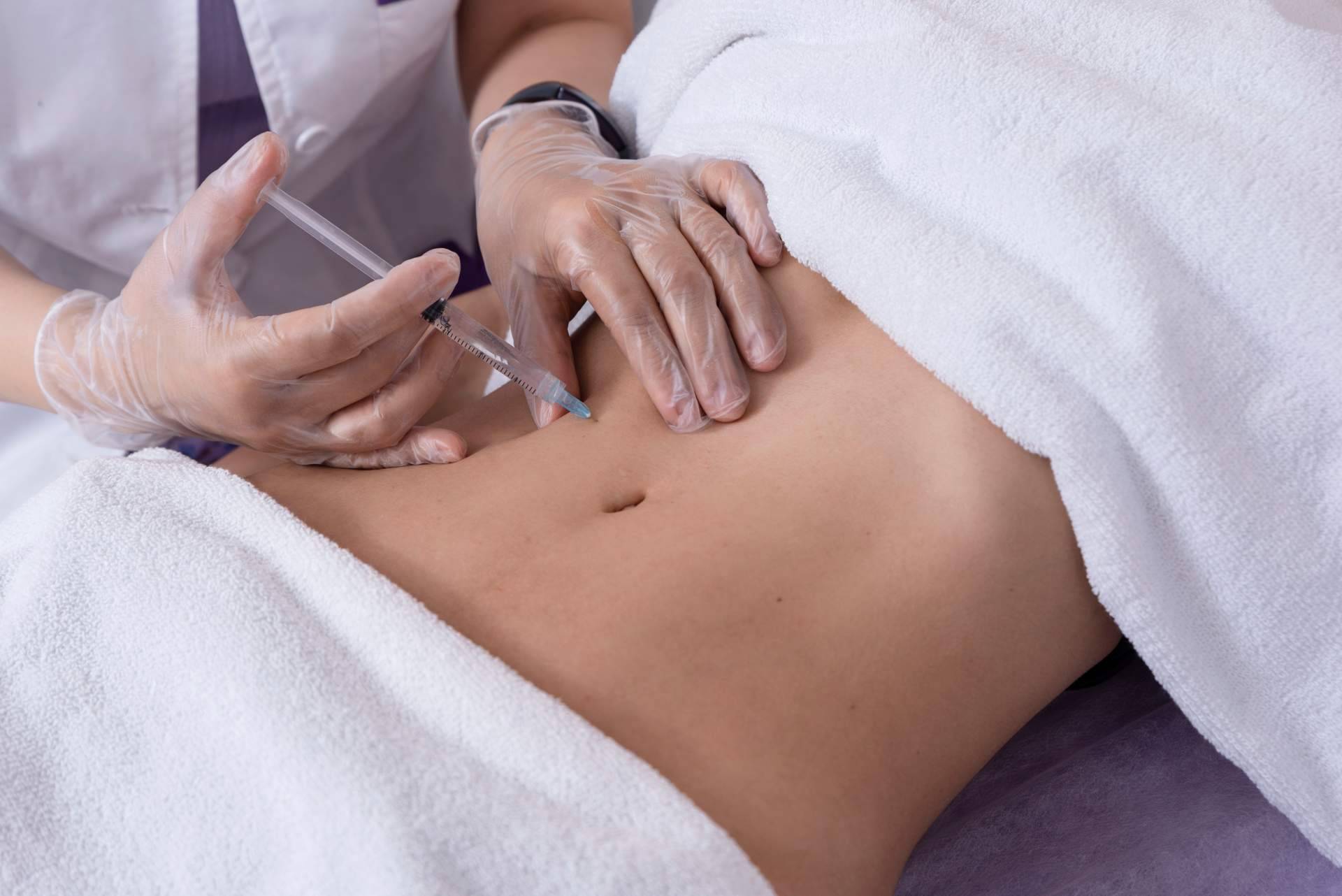 Alluring Clinic lleva a cavo mesoterapia efectiva contra la celulitis