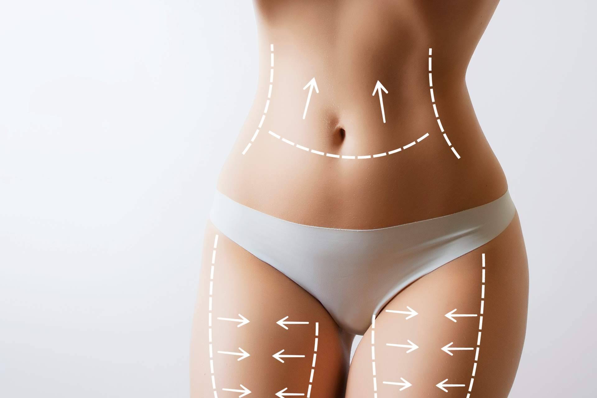 Lipoescultura HD, una tratamiento disponible en  Beauty&Beauty