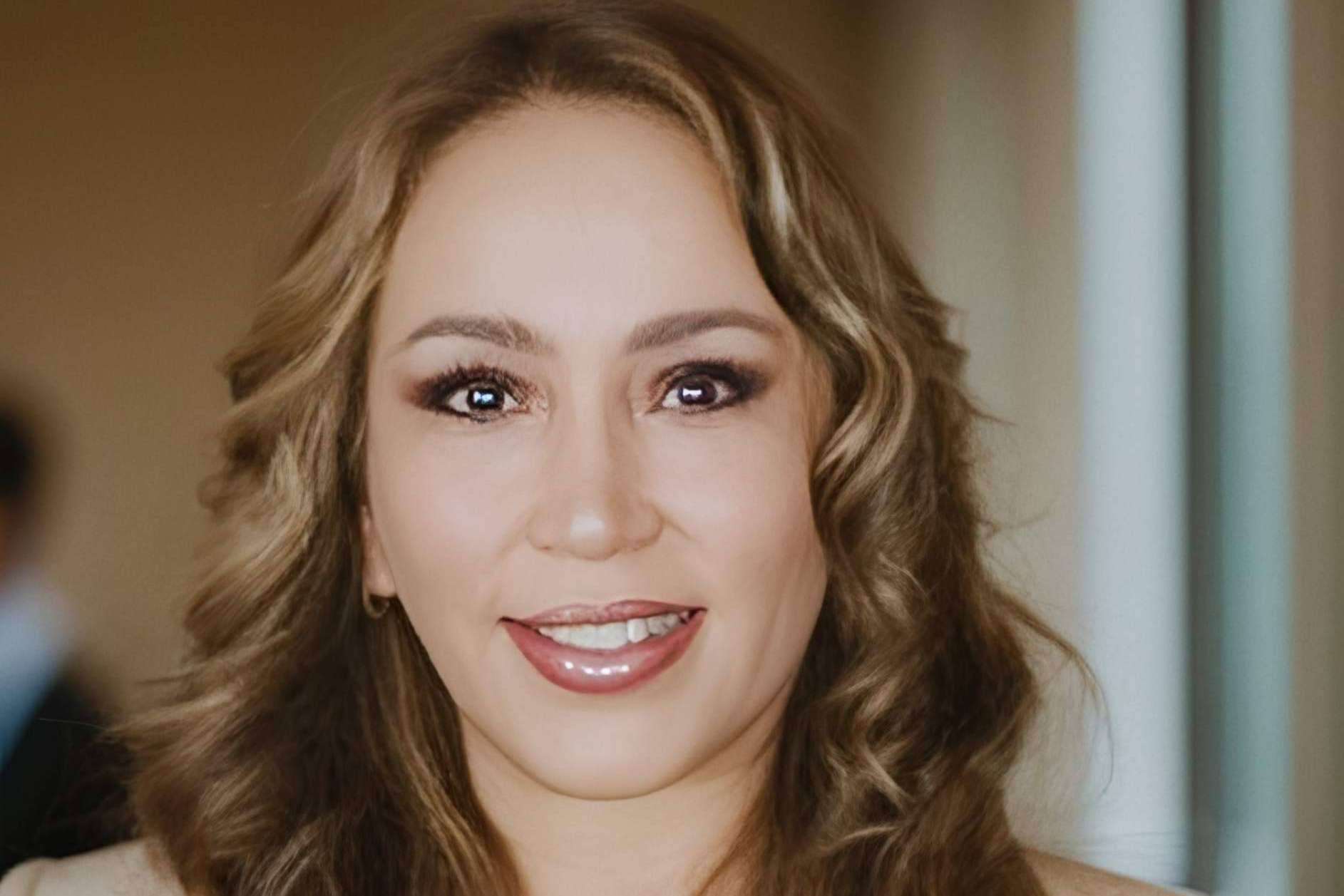 Combatir el acné hormonal provocado por el síndrome del ovario poliquístico, con los tratamientos láser de la Dra. Janeth Arévalo