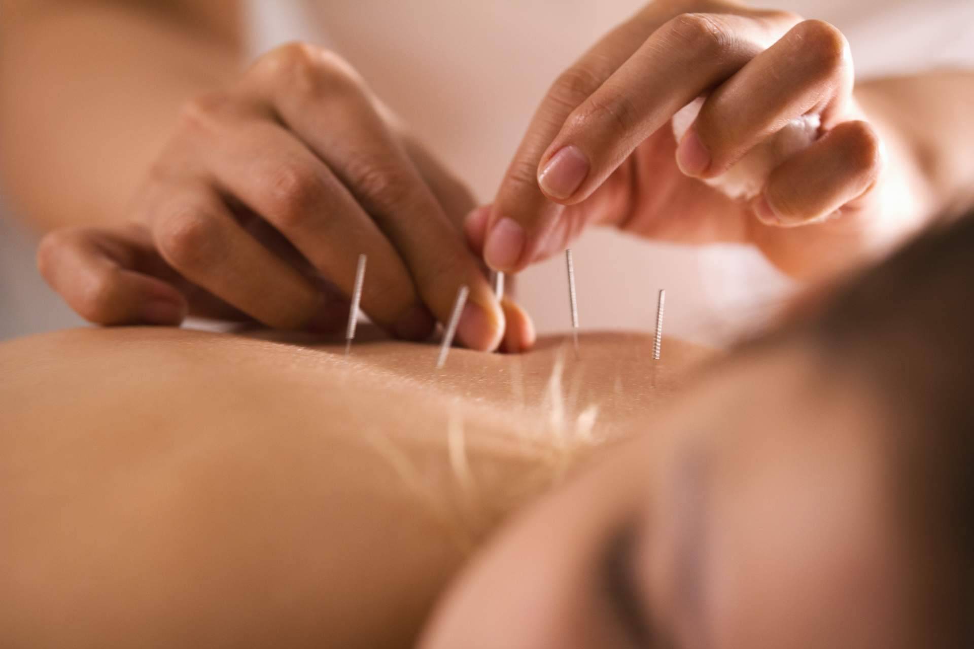 Vital Balance se consolida como un centro especializado en acupuntura en Málaga