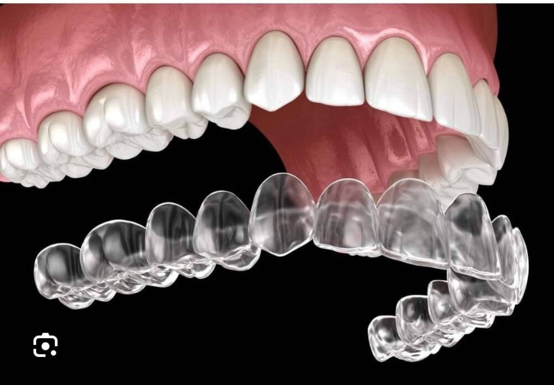 La Clínica Dental Jorge del Corral impulsa la ortodoncia invisible diseñada por ordenador en Hortaleza, Madrid