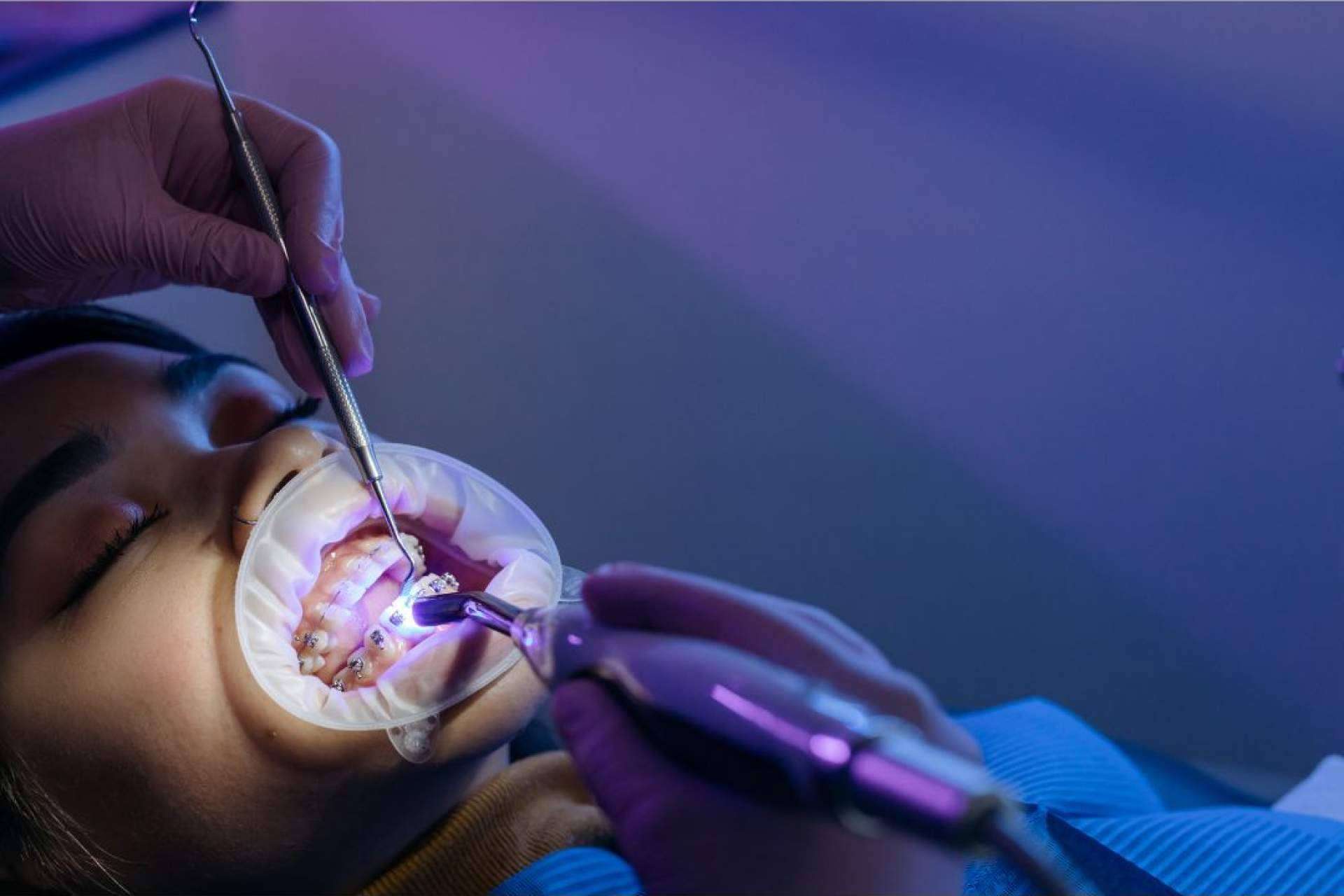 La clínica Denty Dent destaca por sus tratamientos dentales de alta calidad a precios asequibles en Madrid